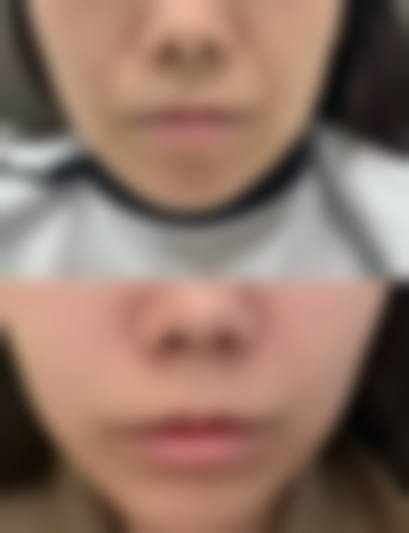 七、青岛市黄岛区中医医院整形美容科预约方式