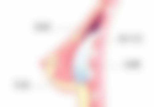 瘦脸针韩国什么牌子好？Meditoxin、乐提葆等优质品牌值得了解！ 