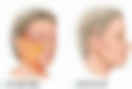 一、为什么茶叶水可以去眼袋