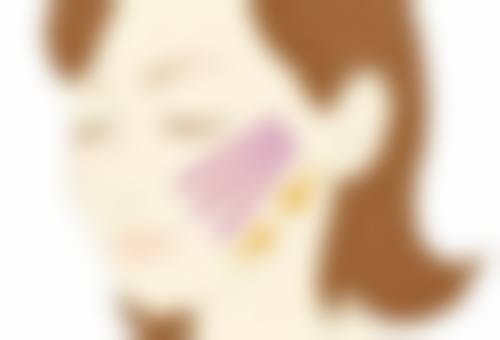 七、点痣后增生疤痕能自己消退吗