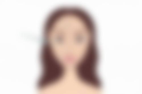 六、点痣后增生疤痕的其他治疗办法