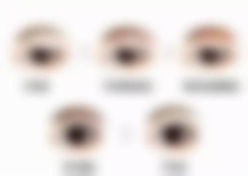 一、修复疤痕成效怎么样？不同疤痕类型的修复差异