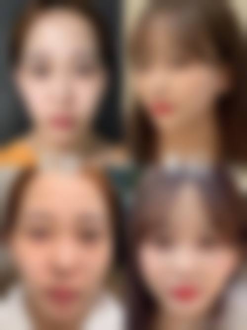 九、襄阳伯蒂整形美容门诊部真实的患者评价