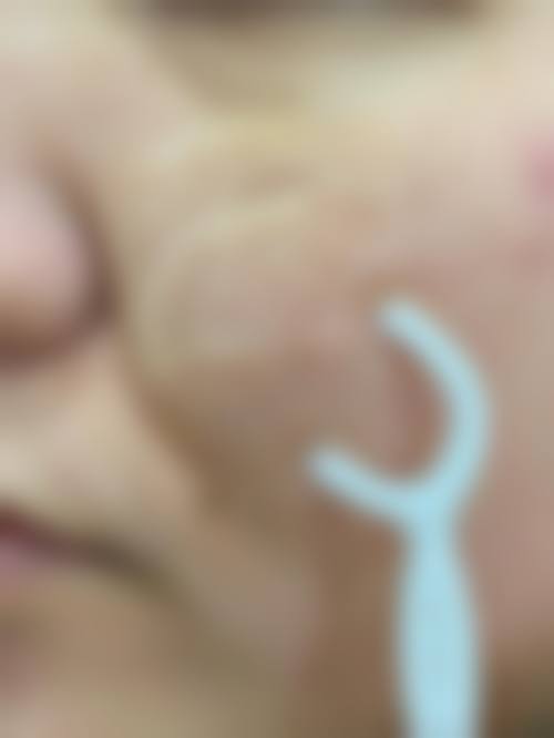 六、杭州余杭区第一人民医院整形科价格表