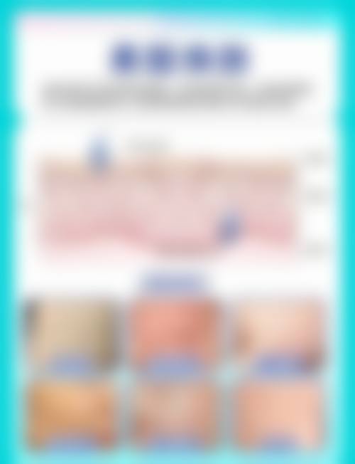 六、深圳康盈美整形美容医院价格表