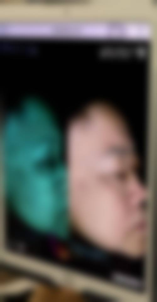 三、北京华信医院皮肤美容科诊疗项目有哪些？