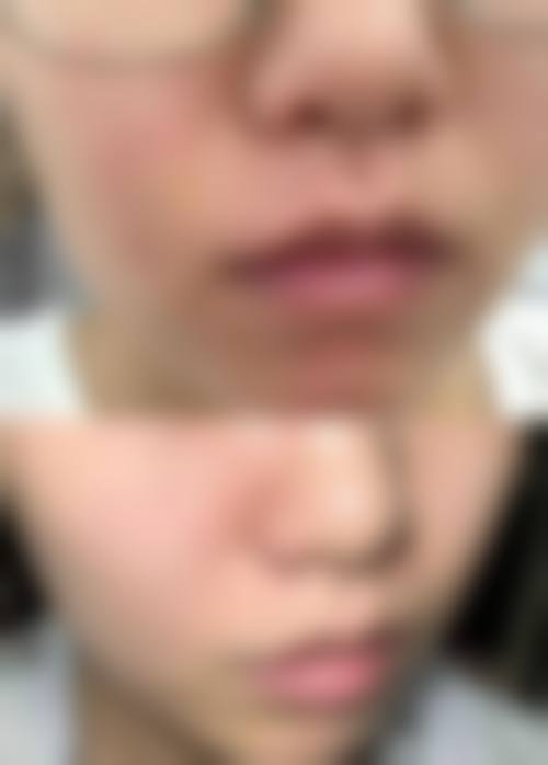 九、深圳康盈美整形美容医院真实的患者评价