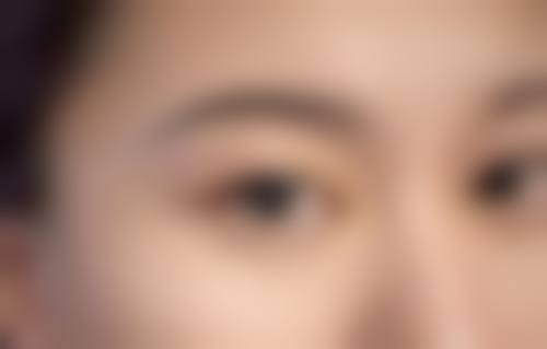 四、成都山之丘整形医院特色项目