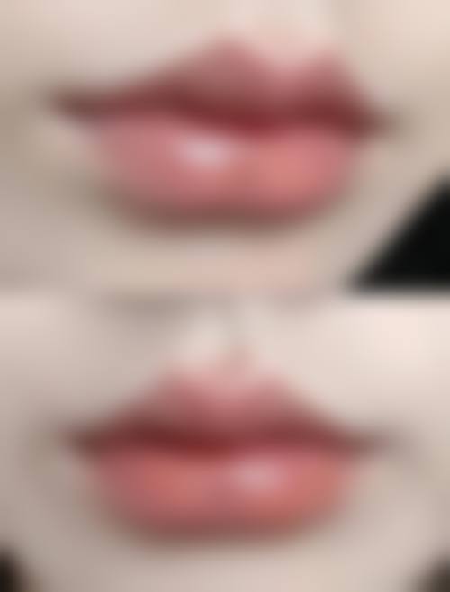 五、厦门酉西儿整形外科门诊部价格表