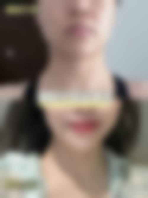 八、通山县漾轻整形医院真实的患者评价