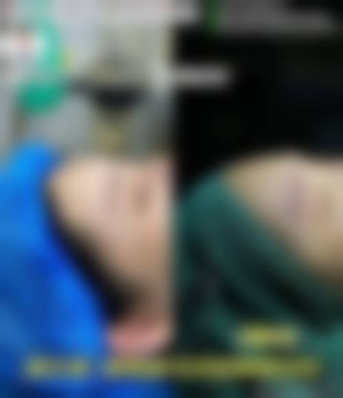 八、河南爱博（杰俊）医疗美容诊所真实的患者评价