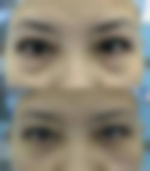 四、通山县漾轻整形医院特色项目