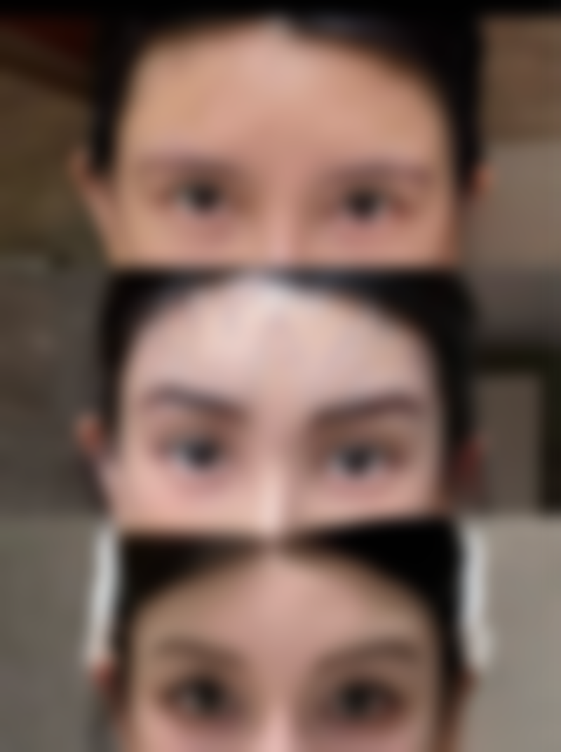 五、浙江金华东阳俪芙美医疗美容价格表