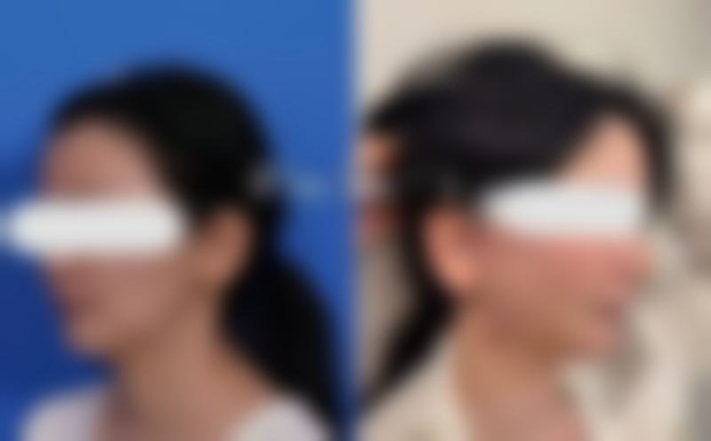 五、驻马店广济医疗美容医院价格表