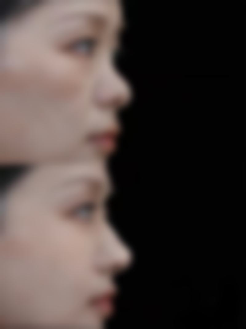 八、浙江金华东阳俪芙美医疗美容真实的患者评价