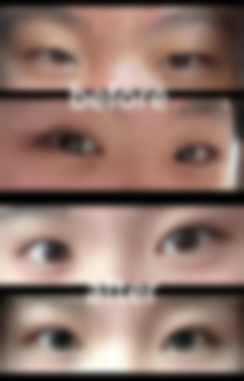 四、福州第一医院整形美容中 心特色项目