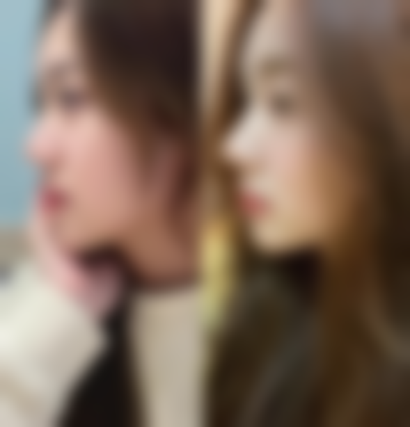 八、总结：数码定位双眼皮能保持多少年？