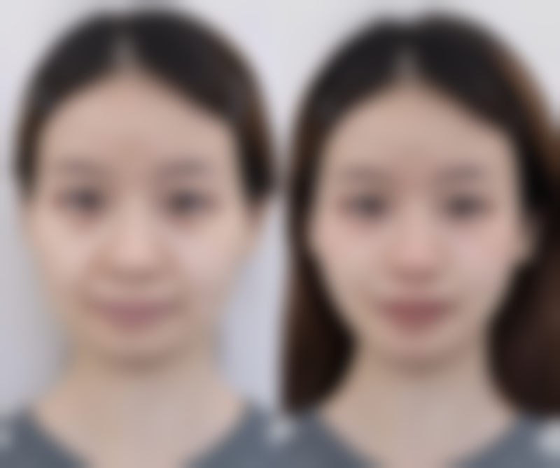 二、影响祛疤药成效的关键因素