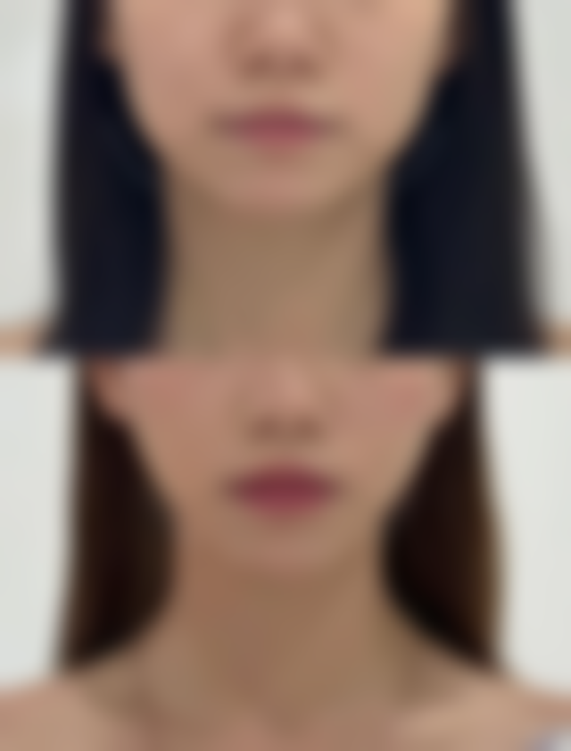 八、成都汉棠汉方医疗美容医院真实的患者评价