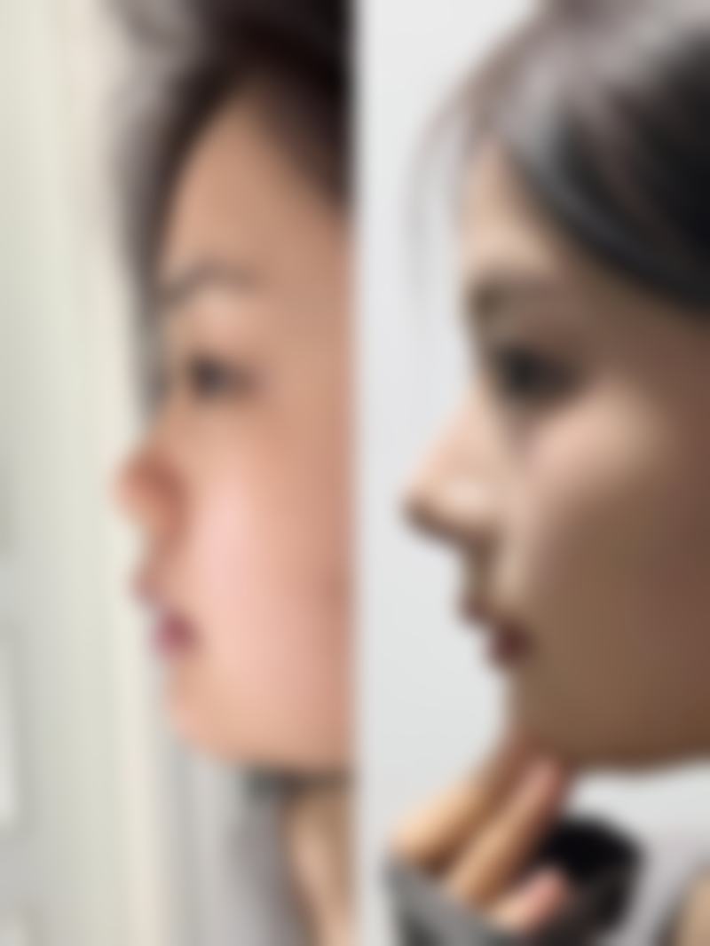 八、新乡穆大夫整形美容医院真实的患者评价