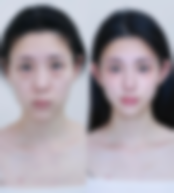 六、修复疤痕成效怎么样？疤痕修复膏真的有用吗