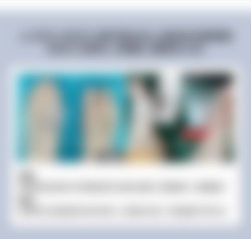 一、割完双眼皮能吃糖醋吗之醋的食用情况