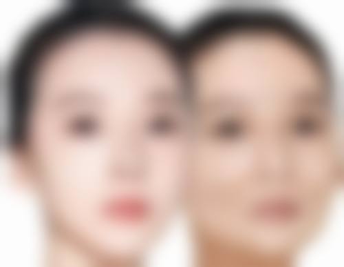 九、青岛恩东整形医院真实的患者评价