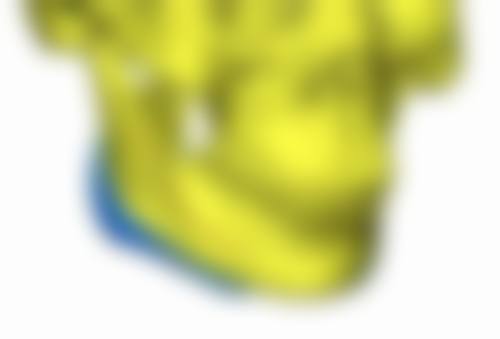 四、狗咬疤痕修复能除掉吗