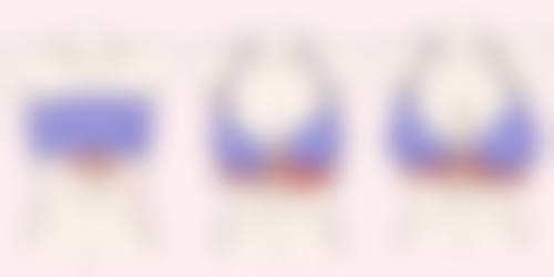 六、上海德琳医疗美容医院乐威男性增粗项目的实例展示