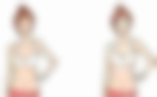 一、在哪做双眼皮比较好之医院选择要点