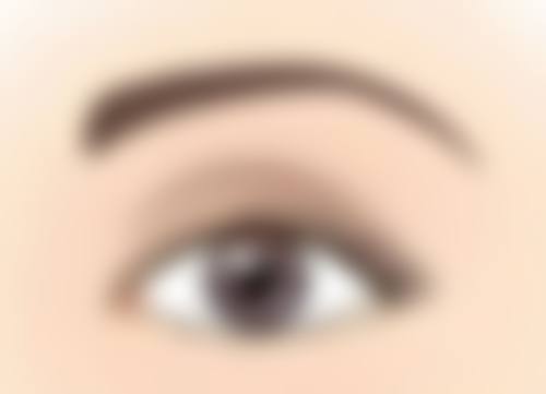 二、做眼袋手术有生命危险吗?手术风险分析