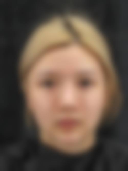 六、洛阳谢景良医疗美容诊所价格表