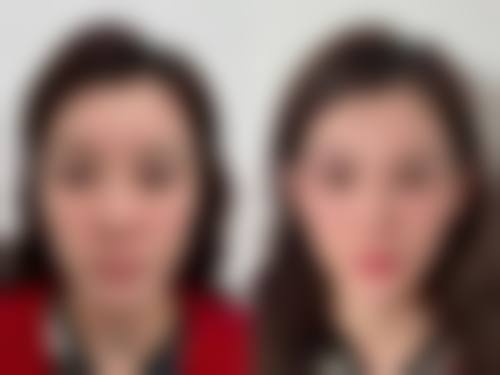 四、衡阳肤康中医皮肤病医院特色项目