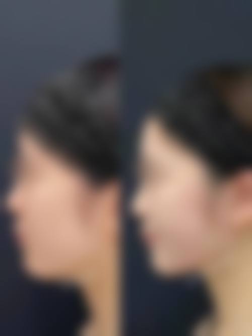 四、重庆芙芮熙雅整形医院特色项目