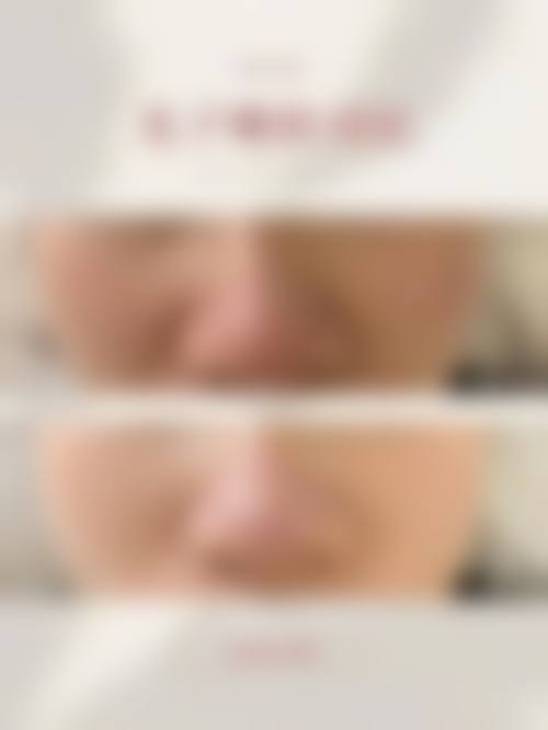 四、西安唯星颜医疗美容门诊部特色项目