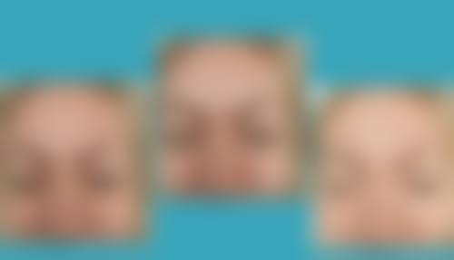 二、韩国 CDU 清潭优整形外科皮肤科怎么样？