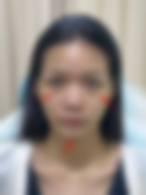 四、洛阳谢景良医疗美容诊所特色项目