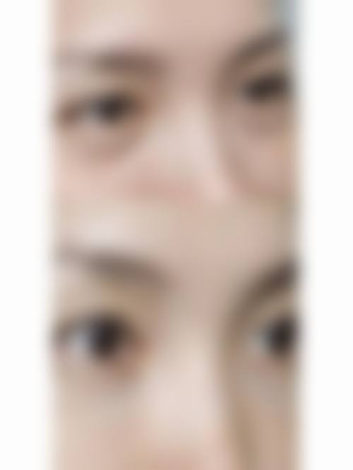 九、洛阳谢景良医疗美容诊所真实的患者评价