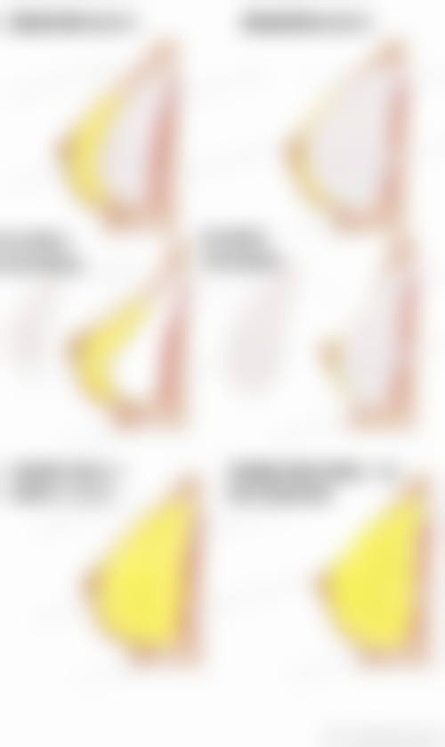 八、保定市新市区宝特医疗美容整形诊所真实的患者评价