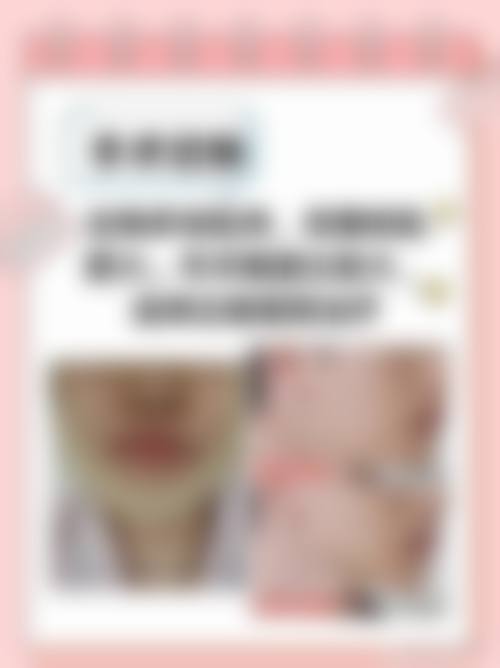 九、衡阳肤康中医皮肤病医院真实的患者评价