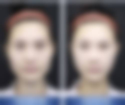 五、天津中 医 药大学第一附属医院整形科价格表