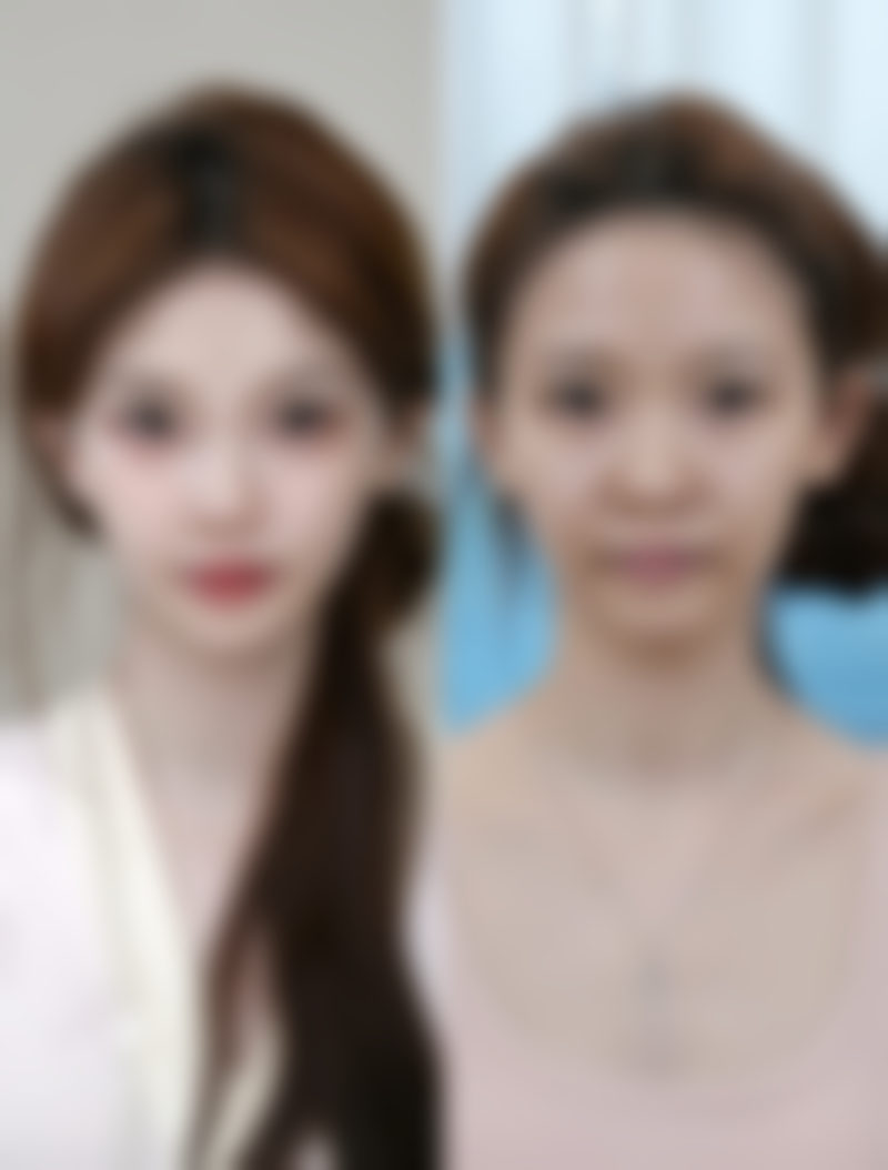 三、手术方式对比（常见类型）