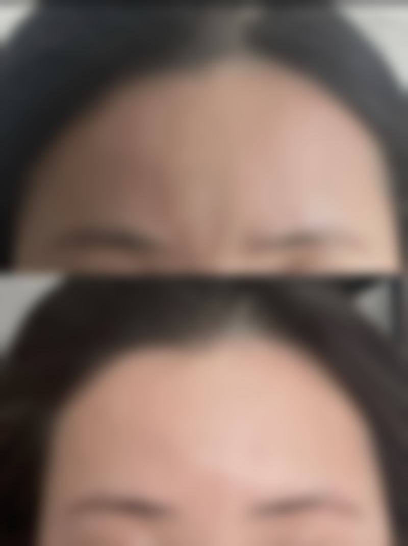 四、西安艺朵脂美人医疗美容医院特色项目