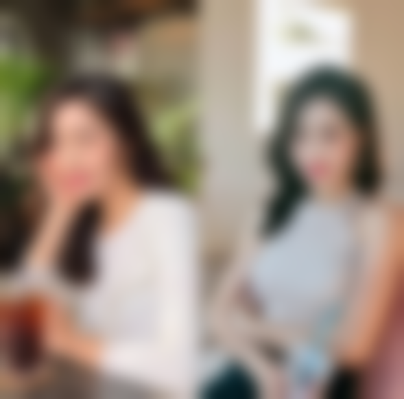 四、刚做的双眼皮消肿之适度活动法