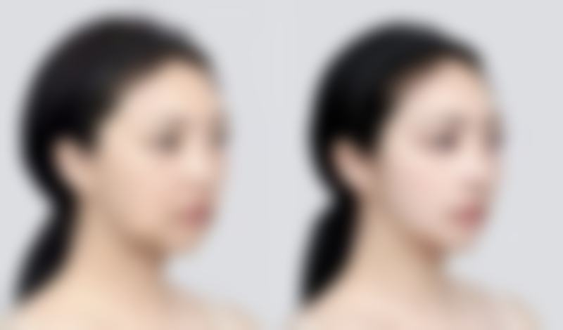 一、了解眼袋细纹形成的原因