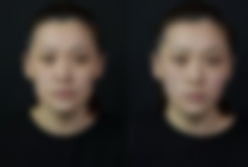 八、天津伊科医疗美容诊所真实的患者评价