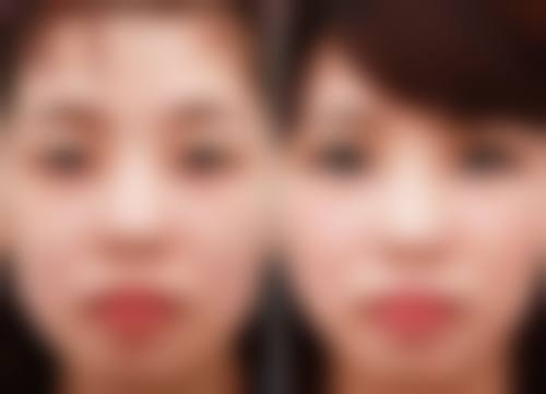 四、兰州中泰整形美容医院特色项目