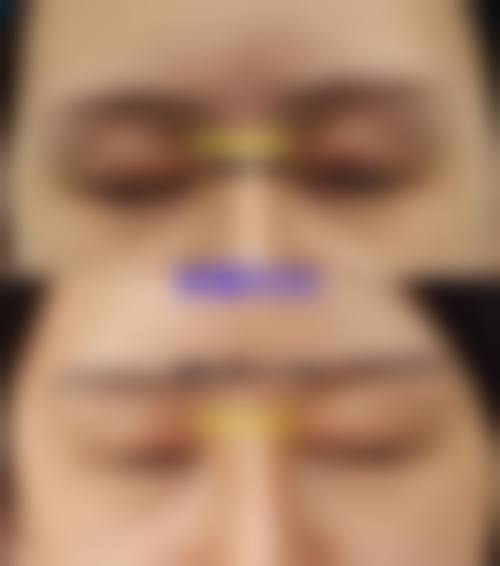 四、眉县赫丽森医疗美容诊所特色项目