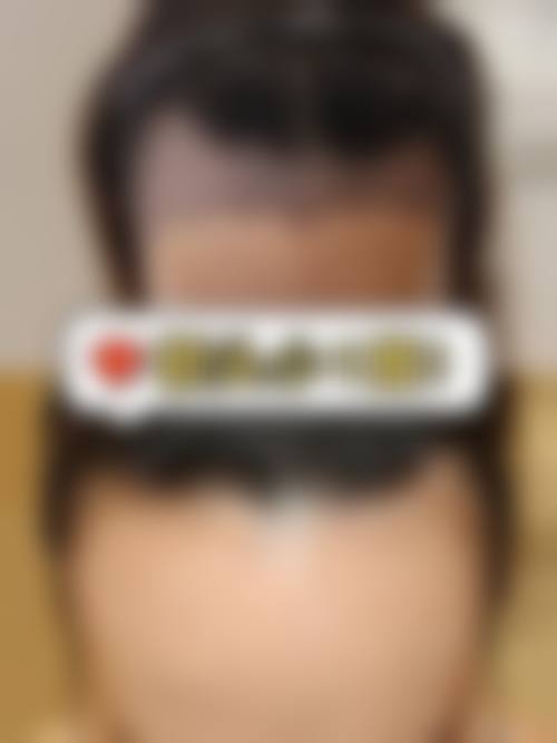 七、重庆李梅博士植发中 心预约方式