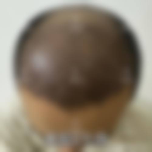 二、重庆李梅博士植发中 心怎么样?